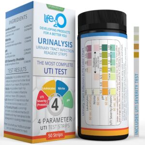 Urinary analysis strips kit (home use)
